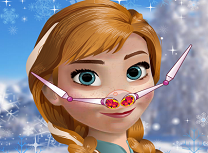 Anna Probleme la Nas