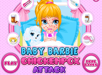 Barbie Are Varicela