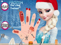 Elsa Tratament la Mana