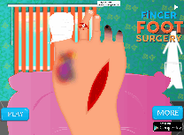 Operatie la Degetul de la Picior