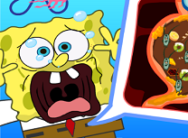 Spongebob Operatie la Stomac
